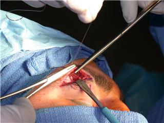 Dr. Stile Facial Plastic Surgery